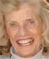 Eunice KENNEDY SHRIVER