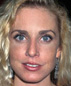 Dana PLATO